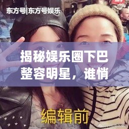 揭秘娛樂圈下巴整容明星，誰悄悄整過下巴？