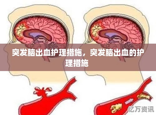 突發(fā)腦出血護(hù)理措施，突發(fā)腦出血的護(hù)理措施 