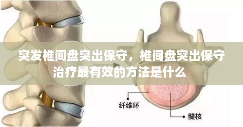 突發(fā)椎間盤突出保守，椎間盤突出保守治療最有效的方法是什么 