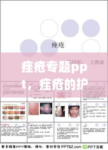 痤瘡專題ppt，痤瘡的護理ppt 